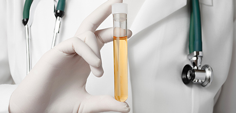 Test tube