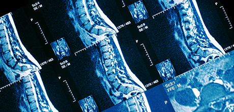 Spine x-ray