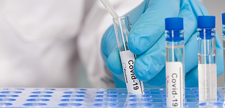 coronavirus antibody test