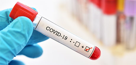 covid-19 positive test
