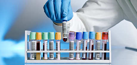 test tubes with blood plasma